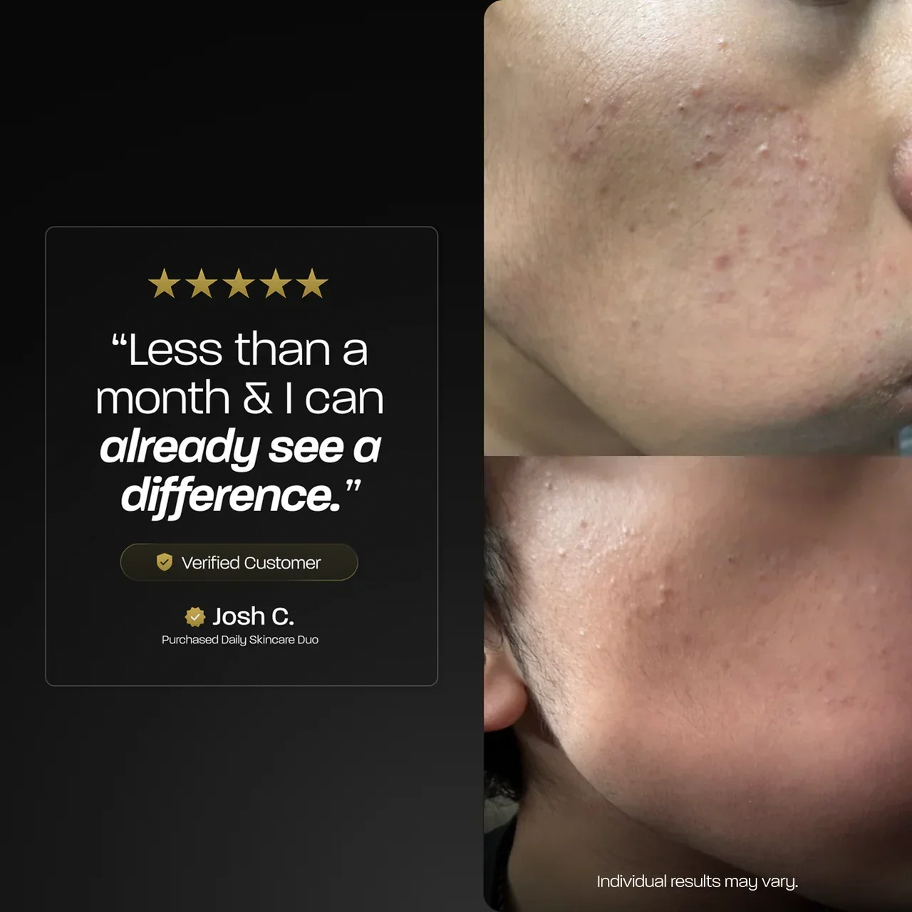 BASED Daily Skincare Duo Skin Care Result