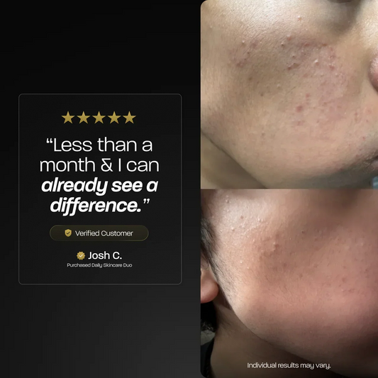 BASED Daily Skincare Duo Skin Care Result